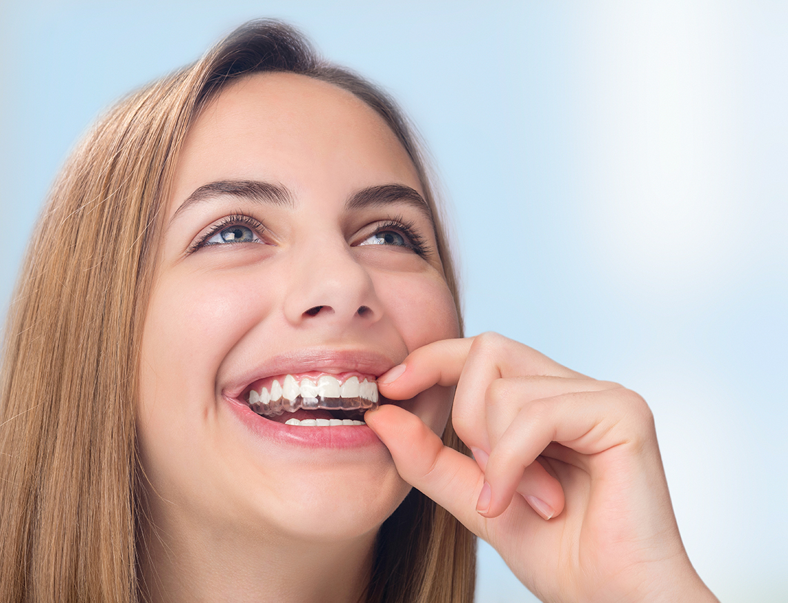 Clear Braces Cerritos CA
