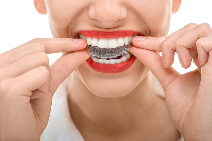 Orthodontic Retainers Cerritos CA